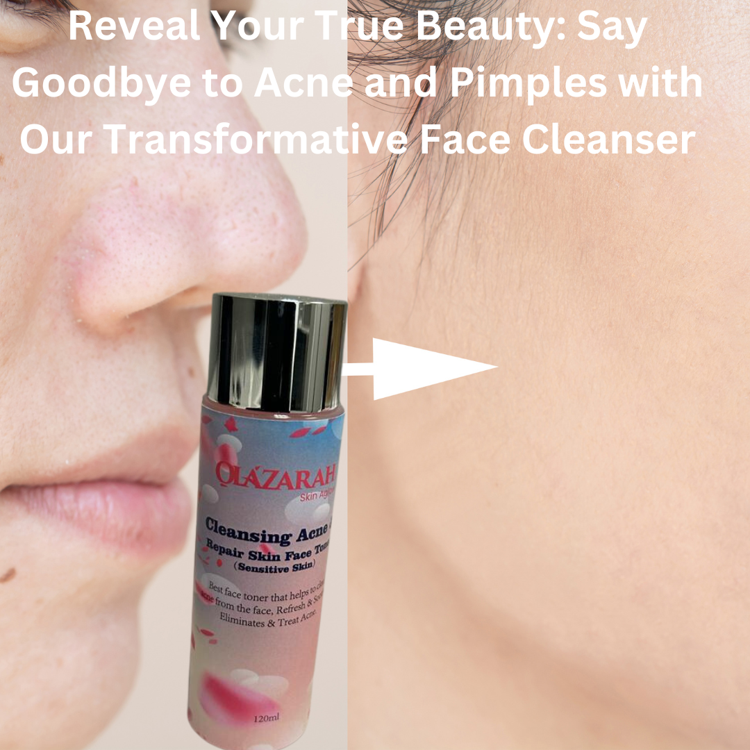 OLAZARAH Clear Acne Repair Skin Face Toner (Sensitive Skin), 4 Fl. oz
