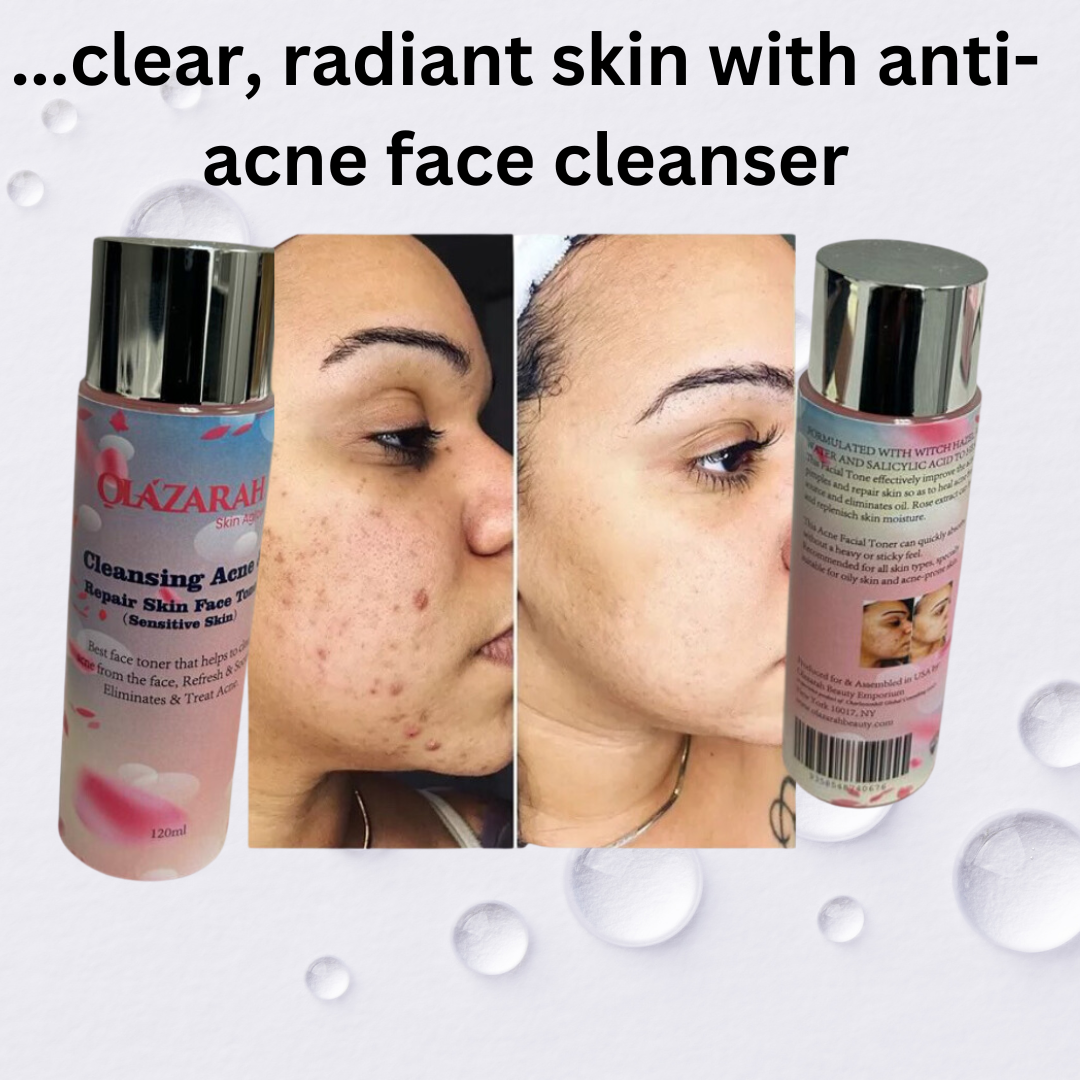 OLAZARAH Clear Acne Repair Skin Face Toner (Sensitive Skin), 4 Fl. oz
